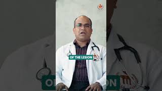 A Comprehensive Guide to Thyroid Neoplasm Diagnosis Explained by Dr Devaraj K [upl. by Yesnel]