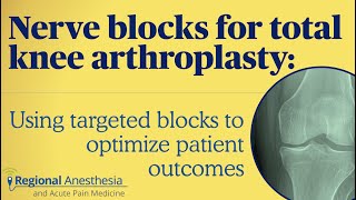 Nerve Blocks for Total Knee Arthroplasty Using Targeted Blocks to Optimize Patient Outcomes [upl. by Gustavus]