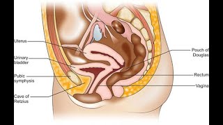 The cave of retzius and its contents  Retropubic space or perivesical space [upl. by Aseefan]