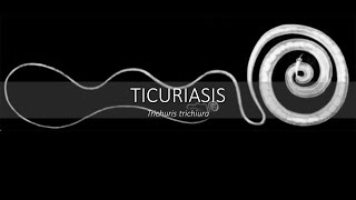 Tricuriasis PREVENCIÓN Y CONTROL resumen  memorización [upl. by Aubin810]