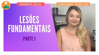 LESÕES FUNDAMENTAIS NA ODONTOLOGIA  PARTE 1 CONCURSO PÚBLICO [upl. by Leirraj]