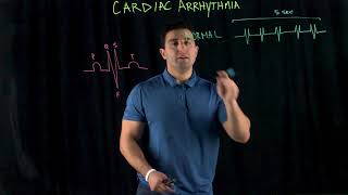 Cardiac Arrhythmia [upl. by Hiller342]