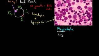 Macrocytic Anemia [upl. by Evette80]