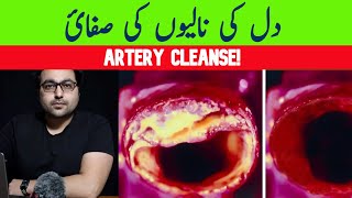 Dr ZeeThe BEST Meal to Clean Out Your Arteries [upl. by Myo50]