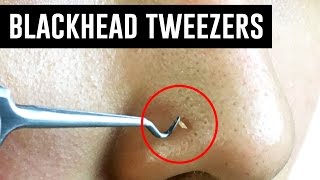 Tweezers That Remove Blackheads TINA TRIES IT [upl. by Yroc]