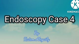 ENDOSCOPY CASE 4 httpsyoutubecomchannelUCaFBRNNQOikWUMjiHP4qneQ [upl. by Aerdnahs]