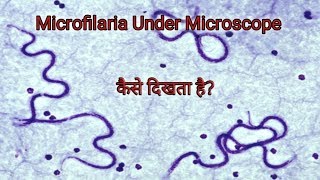 Microfilaria under Microscope [upl. by Iretak]