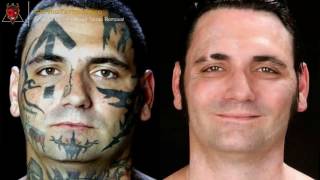 👹 Remove Tattoo With Salt – Everything you need to learn about tattoo removal Article teaser [upl. by Amador882]