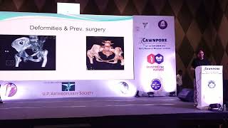 14 Cawnpore Arthroplasty Course 2023 Day 2 Part 21 [upl. by Kcirted]