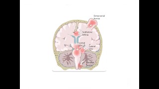 Understanding Kernohans Phenomenon  Central Nervous System  Internal Medicine [upl. by Arob]