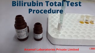 Bilirubin Test Procedure  Bilirubin Total Test [upl. by Iden]