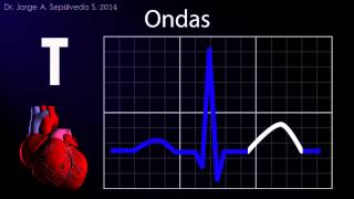 Electrocardiografía Básica Parte 14 [upl. by Dnalyram]