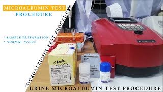 Microalbumin Test Procedure ।। Urine for MicroAlbumin Test Procedure MicroAlbumin Test [upl. by Dell]