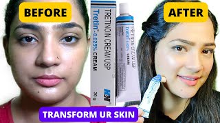 I Used Tretinoin for 1 Year and THIS happened  Tretinoin Update Pm Skin Care Routine with retinA [upl. by Asher]