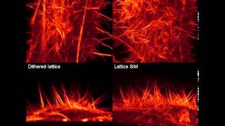 Filopodia in a HeLa Cell [upl. by Atalie]