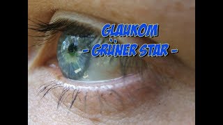 Erkrankungen der Augen  Glaukom oder grüner Star [upl. by Hylton]