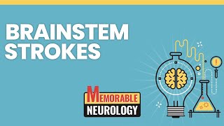 Brainstem Stroke Mnemonics Memorable Neurology Lecture 15 [upl. by Banna]