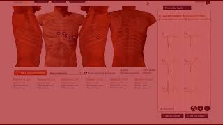 Errores en la realización del electrocardiograma electrodos y cables [upl. by Rita]