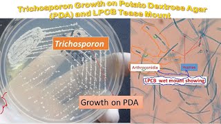 Trichosporon colony morphology on PDA and LPCB Mount Microscopy [upl. by Conlan]