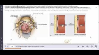 HIT 208 PortaCath Removal External vs Open Approach Explained [upl. by Conias]