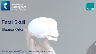 The Fetal Skull [upl. by Tollmann]