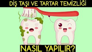 DOĞAL YOLLARLA DİŞ TAŞI VE TARTAR TEMİZLİĞİ NASIL YAPILIR [upl. by Siradal280]