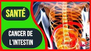 17 Symptômes du CANCER DE LINTESTIN [upl. by Pasquale193]