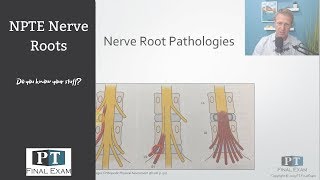 Spinal Pathologies and Discs on the NPTE [upl. by Ermeena]