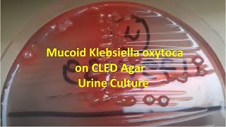 Klebsiella oxytoca on CLED Agar of Urine Sample [upl. by Llewej]