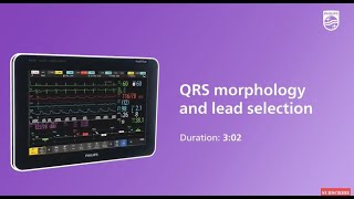 QRS morphology and lead selection at the IntelliVue patient monitor [upl. by Nevanod755]