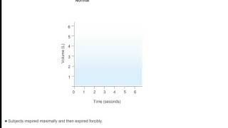 FVC and FEV1 in Normal Subjects [upl. by Rogerg]