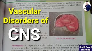 Vascular Disorders of CNS Lecture 6 [upl. by Alaric]