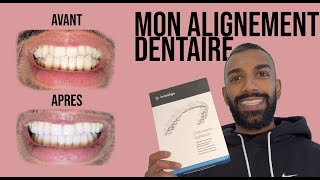 Mon alignement dentaire INVISALIGN [upl. by Gould]