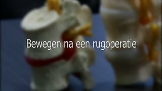 Bewegen na een rugoperatie [upl. by Suez]