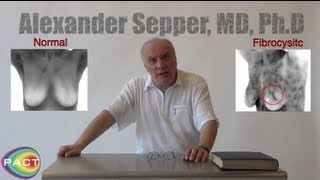 Breast Thermography and Fibrocystic Breast Disease W Dr Alexander Sepper [upl. by Kutzenco]