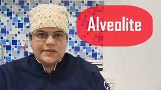 ALVEOLITE o que é Como EVITAR ComoTRATAR  Dra Bianca Rosa [upl. by Scheers]