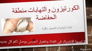 ❌احذرى كريمات شائعة تستخدم لالتهابات منطقة الحفاضة🚼🚼 napkin dermatitis [upl. by Ttocs]