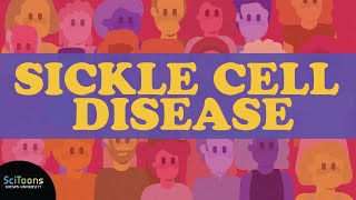 Sickle Cell Disease SCD A Neglected Global Health Burden [upl. by Hereld]