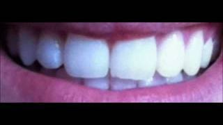 Blend a med Whitestrips [upl. by Ameyn469]