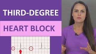 ThirdDegree AV Heart Block ECG Nursing Rhythm NCLEX  Complete Heart Block [upl. by Arsi728]