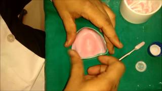 denture base preparation [upl. by Allveta]