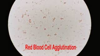 Red Blood Cell Under the Microscope 400X and 1000X  Part 3 RBC Agglutination [upl. by Aan]