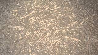 C2C12 differentiated cells in 2 horse serumtwitching [upl. by Dnumyar63]