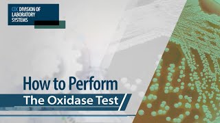 How to Perform the Oxidase Test [upl. by Keram]