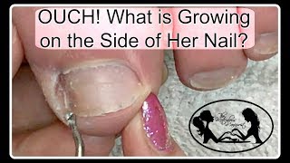 Pedicure Tutorial What Mimics Ingrown Toenail Pain Pro Tools Available on My Online Store ✔️ [upl. by Bishop]