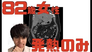 【わかりますか？】発熱しか症状がない82歳女性の症例報告 [upl. by Narud]