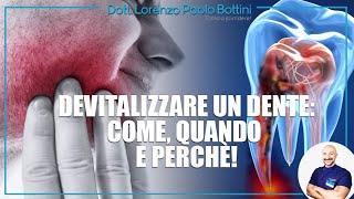 Impianto Dentale Cosè e come funziona [upl. by Nwahsirhc]