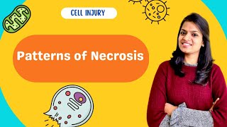 Cell injury and Necrosis part 2 patterns of necrosis [upl. by Imoyik]