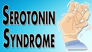 Managing Serotonin Syndrome [upl. by Atalayah]