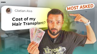 ❗️ Hair Transplant Cost [upl. by Osher582]